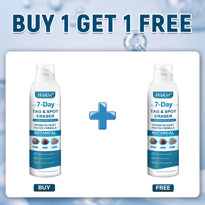 Official Brand Store | ✅💎 Hiskin® 7-Day Tag & Spot Eraser (Zero Pain, Zero Scars Precision Spray)
