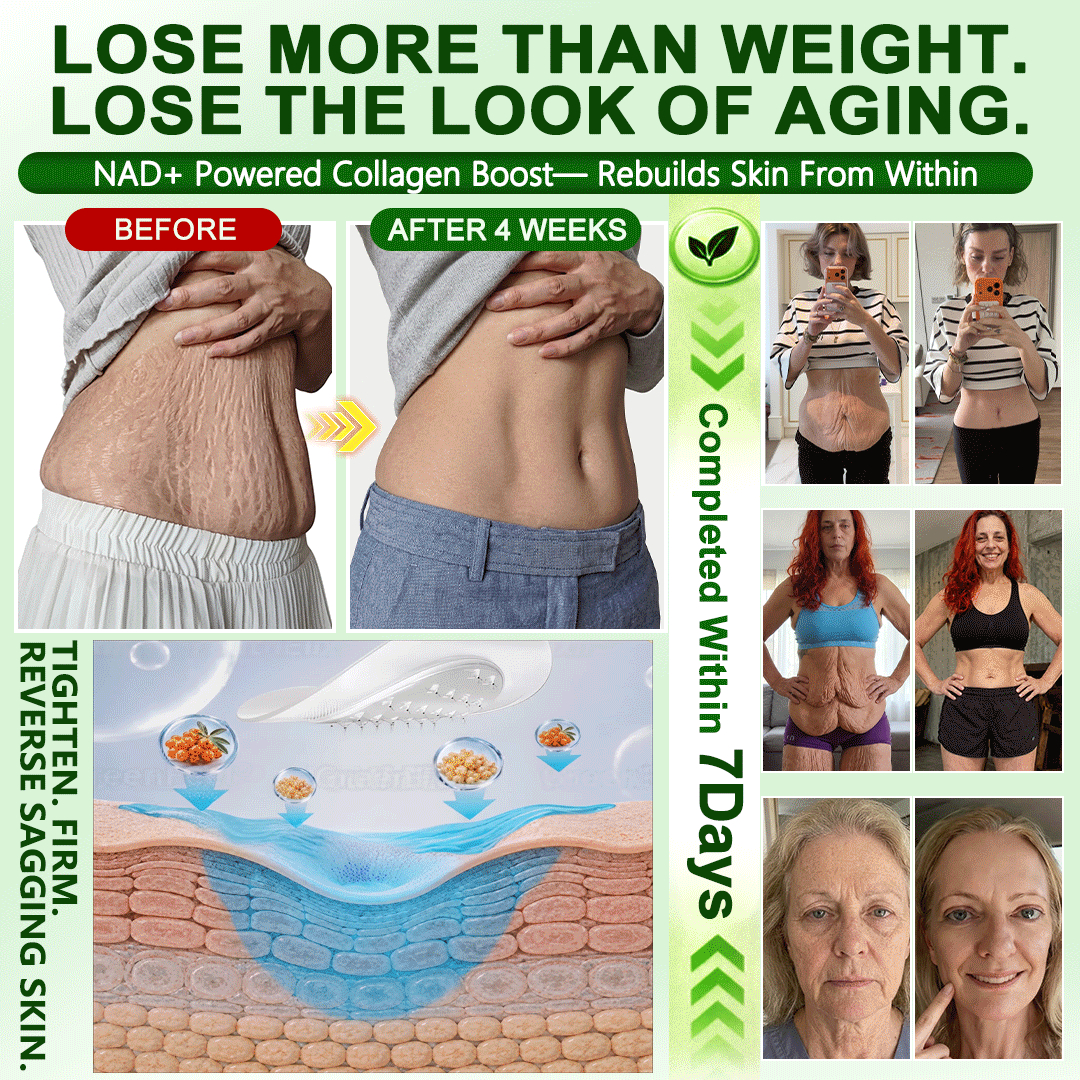 𝑶𝒇𝒇𝒊𝒄𝒊𝒂𝒍 𝑺𝒕𝒐𝒓𝒆 | 𝐍𝐞𝐰!🍀🍀𝐆𝐫𝐞𝐞𝐧𝐅𝐞𝐞𝐥® 𝐌𝐨𝐫𝐢𝐧𝐠𝐚 × 𝐁𝐞𝐫𝐛𝐞𝐫𝐢𝐧𝐞 × 𝐍𝐀𝐃+ 𝟏𝟎-𝐢𝐧-𝟏 𝐍𝐚𝐧𝐨 𝐌𝐢𝐜𝐫𝐨𝐧𝐞𝐞𝐝𝐥𝐞 𝐍𝐮𝐭𝐫𝐢𝐭𝐢𝐨𝐧 𝐏𝐚𝐭𝐜𝐡 🇨🇦 (𝐉𝐮𝐬𝐭 𝐨𝐧𝐜𝐞 𝐚 𝐝𝐚𝐲, 𝐯𝐢𝐬𝐢𝐛𝐥𝐞 𝐜𝐡𝐚𝐧𝐠𝐞𝐬 𝐢𝐧 𝟕 𝐝𝐚𝐲𝐬）𝘽𝙚𝙧𝙗𝙚𝙧𝙞𝙣𝙚 + 𝙈𝙤𝙧𝙞𝙣𝙜𝙖 𝙁𝙤𝙧𝙢𝙪𝙡𝙖 ✅ 𝐅𝐨𝐫 𝐨𝐛𝐞𝐬𝐢𝐭𝐲, 𝗟𝗼𝗼𝘀𝗲 𝘀𝗸𝗶𝗻,𝐝𝐢𝐚𝐛𝐞𝐭𝐞𝐬, 𝐬𝐥𝐞𝐞𝐩 𝐚𝐩𝐧𝐞𝐚, 𝐣𝐨𝐢𝐧𝐭 𝐢𝐬𝐬𝐮𝐞𝐬, 𝐚𝐧𝐝 𝐦𝐨𝐫𝐞💯💯