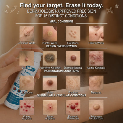 Official Brand Store | ✅💎 Hiskin® 7-Day Tag & Spot Eraser (Zero Pain, Zero Scars Precision Spray)